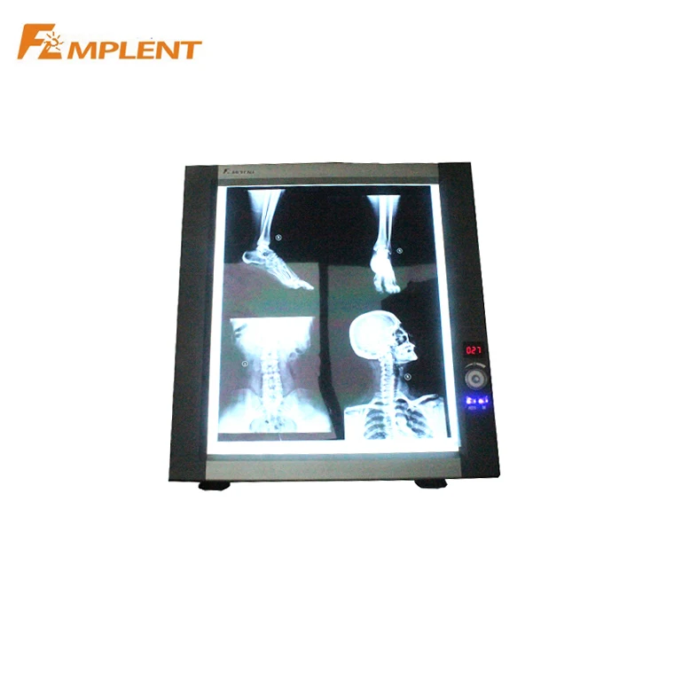  Stable performance Mplent ZG- 1C radiographic dental x ray film viewer suppliers