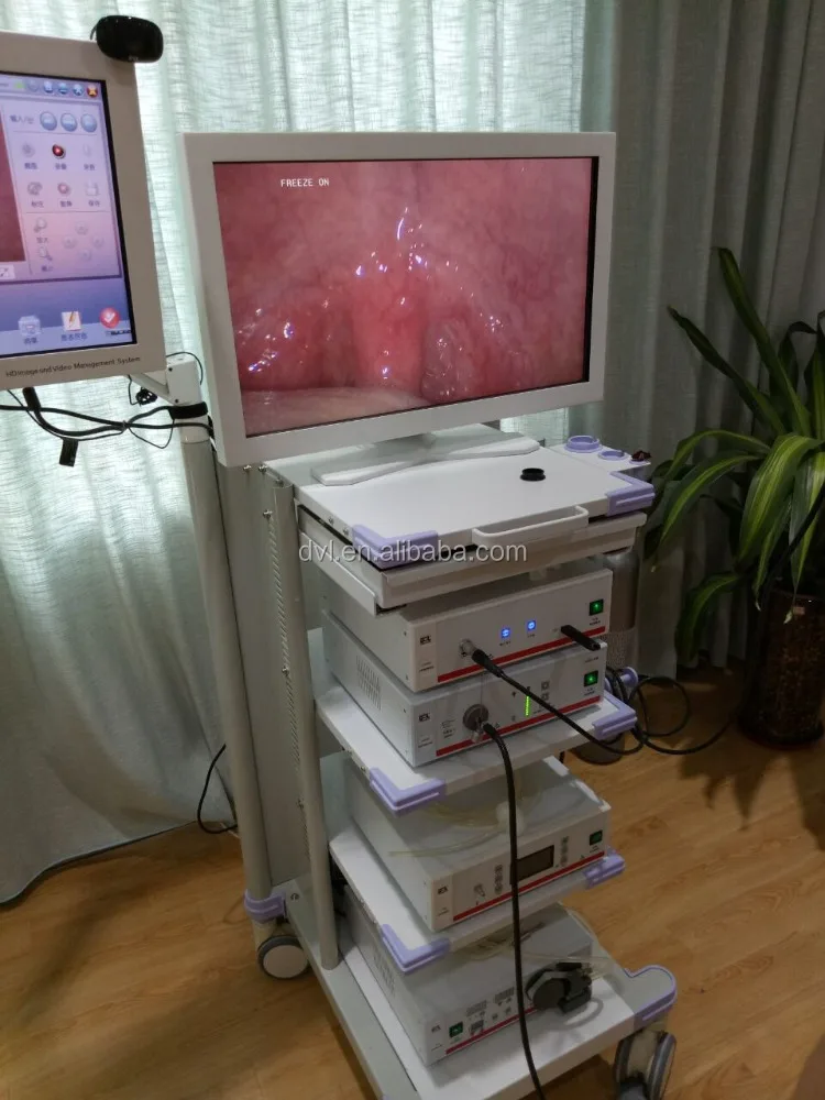 Professional Medical Laparoscopy surgery equipment Full HD endoscopy camera with screen 1080p