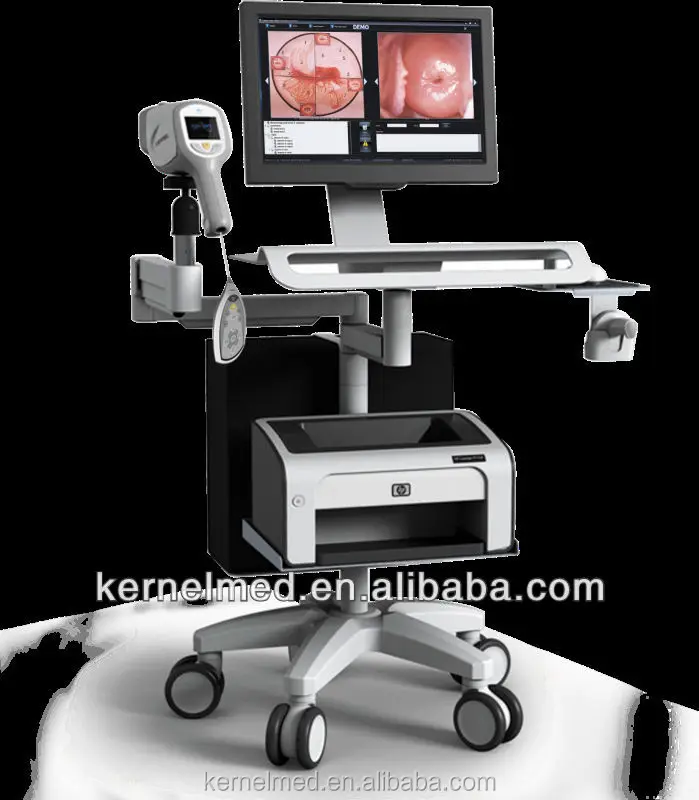 Digital HD Vagina Colposcope for Gynecology/Video Colposcope For Vagina KN-2200I