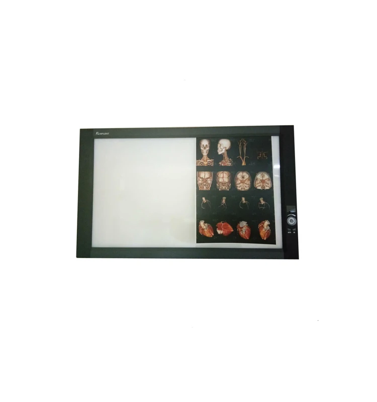 Mplent top sales ZG-2C smart led slim x-ray film viewer negatoscope X Ray illuminator with CE with ISO13485 factory