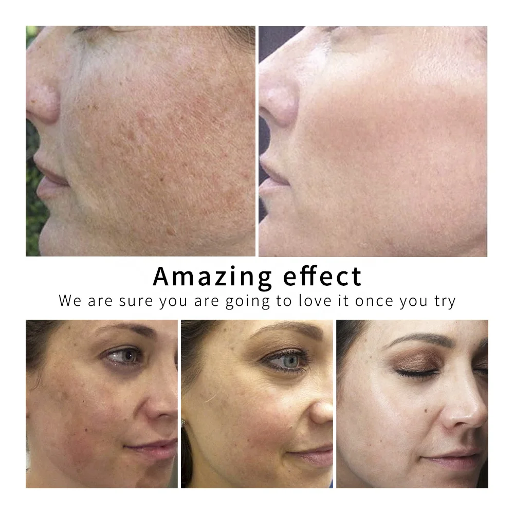 
Gold Silk Acido Hialuronico Face Serum Collagen Ampoule Pure Foil Essence Serum Anti Wrinkle Anti-Aging Serum 