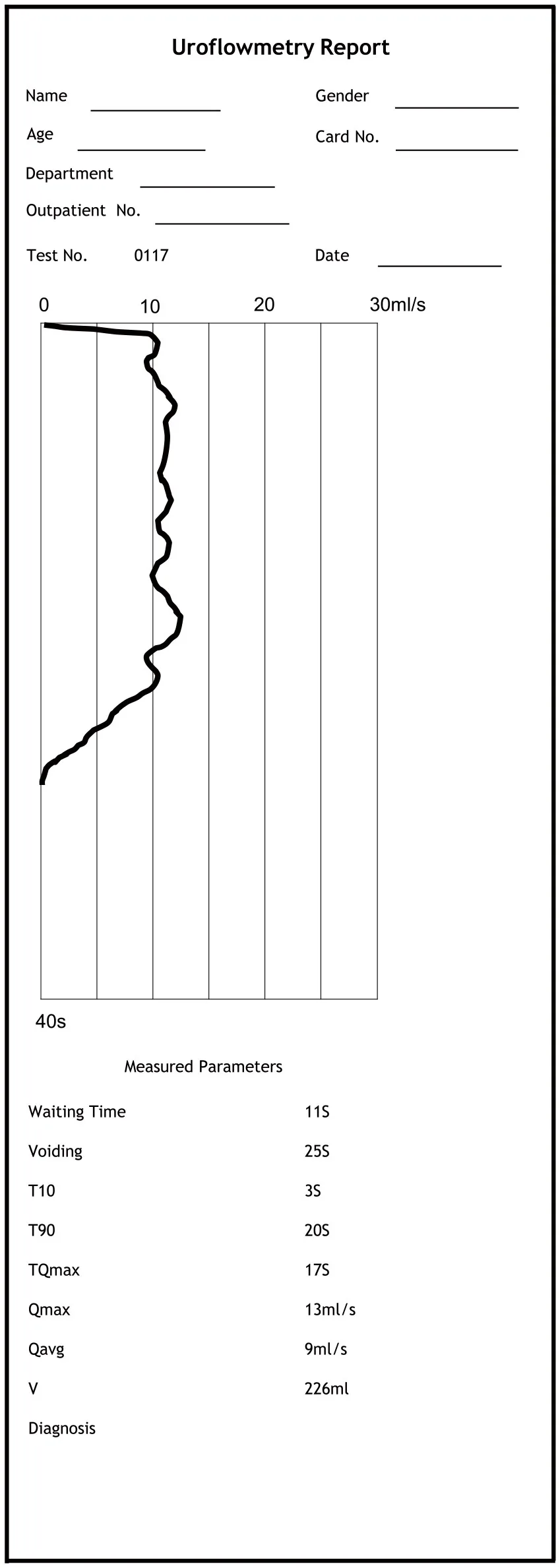 
Free Shipping OEM direct factory CE mark Uroflowmeter,Urine flow meter for urology hospital 