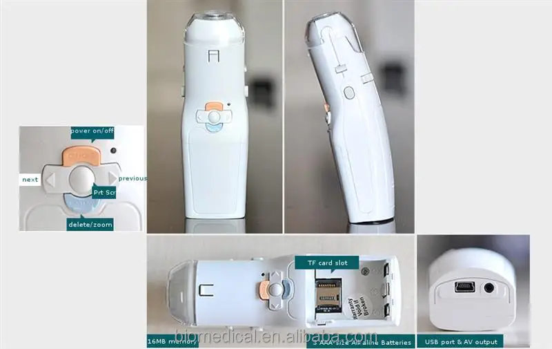 Mini Colposcopy USB Colposcopes For Sale Video Bolposcope Price