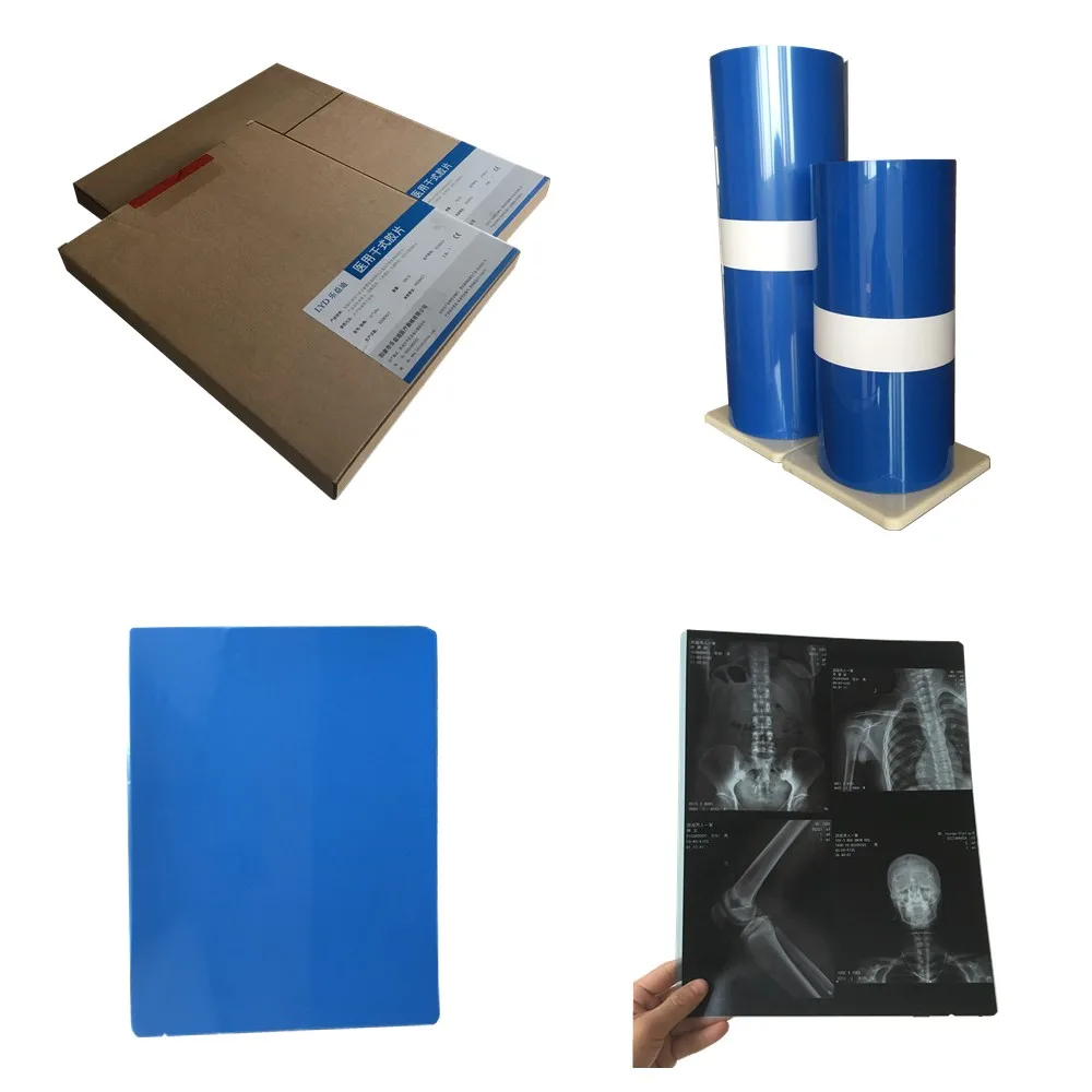 
Factory medical image and x ray film for Canon film printer 13X17 