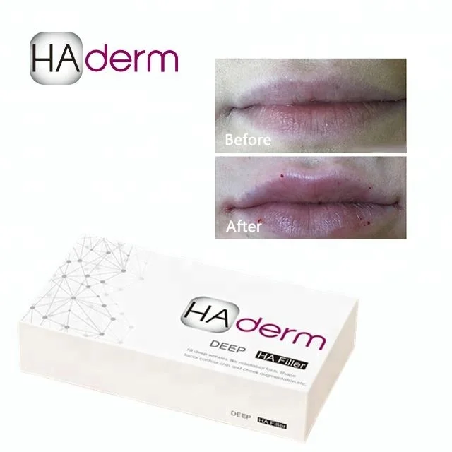  Горячая Распродажа CE HAderm 1 мл Гиалуроновая кислота для лица и