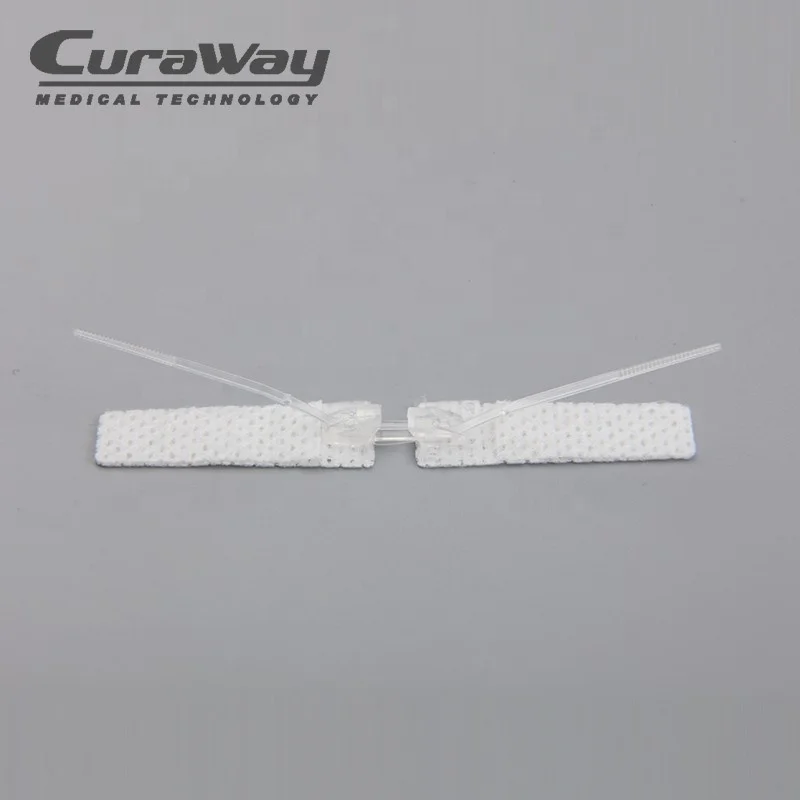 
Disposable Medical Supply Surgical Non-invasive Wound Skin Closure Suture Device 