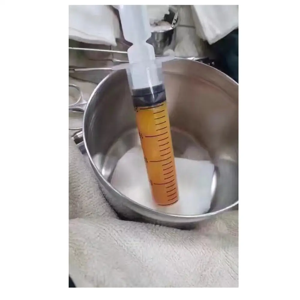Good price centrifuged blood for liposuction