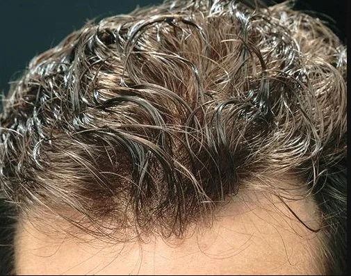 Thin skin natural hairline v-loop injected Single knot wig for men price Remy Human Indian Hair replacement system OEM Factory