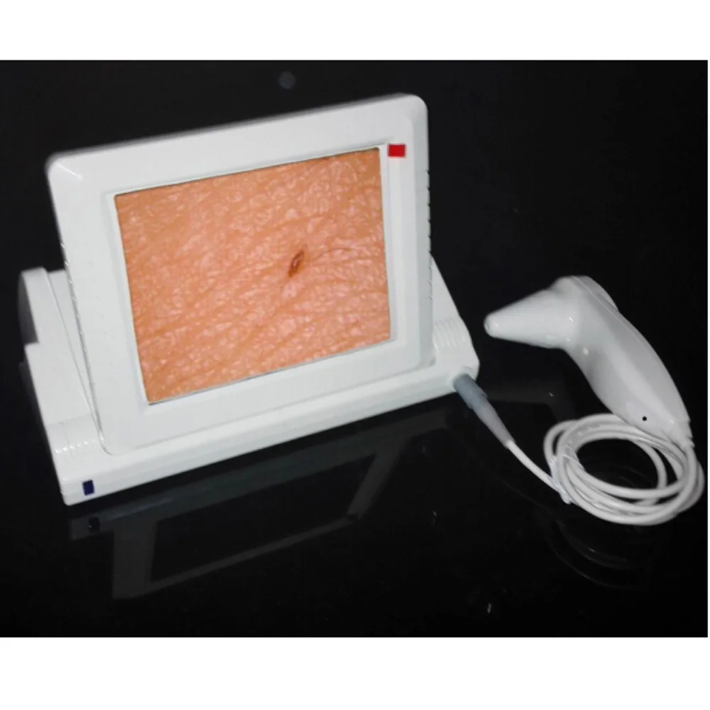 J015(CE) professional skin analyzer for hair and skin iris microscope