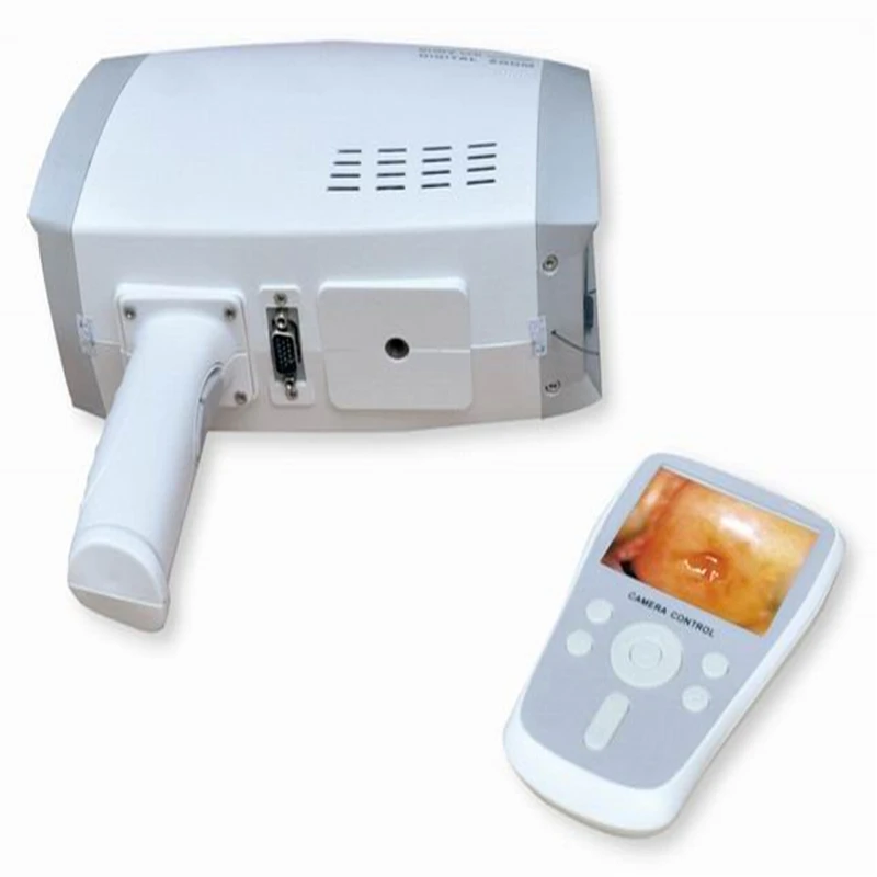 Full ScreenFull HD Camera For Vagina Colposcope Surgical With Low Price