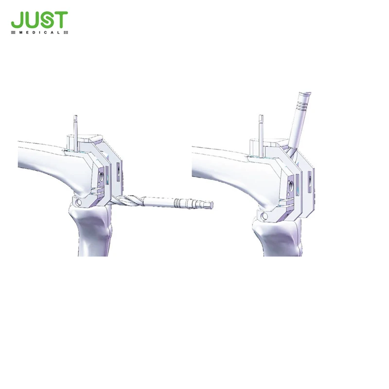 
Good quality and best price Knee prosthesis Primary knee joint prosthesis from China manufacturer 
