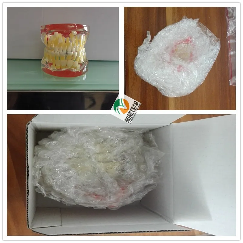 BIX-L1006 Transparent baby teeth pathological dental model