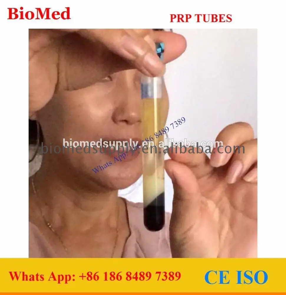 hot sale & high quality skin treatment prp kit
