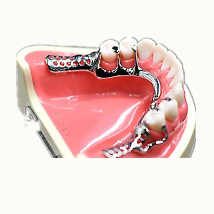 
3d printed dental frame 