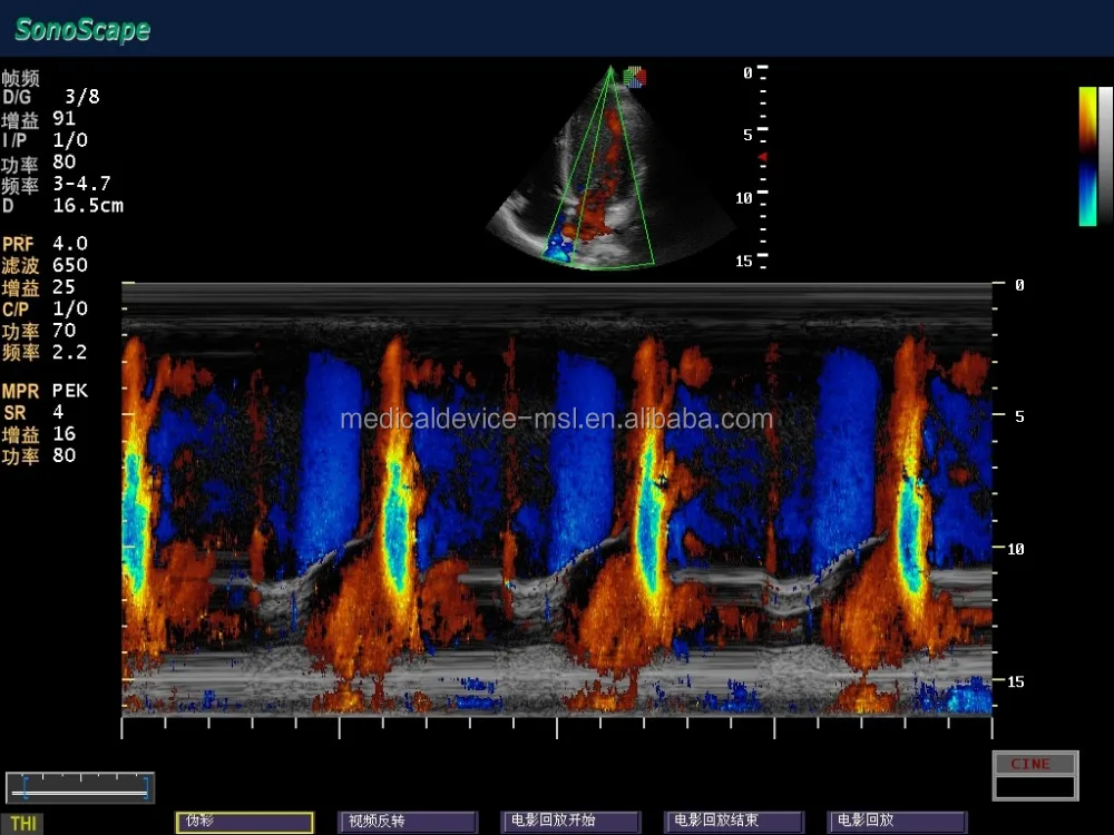 2019 Advanced Technology 4D Imaging sonoscape s8 portable ultrasound machine