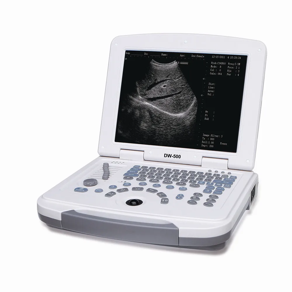 DW-500 China Portable Laptop ultrasound machine with Cheapest price