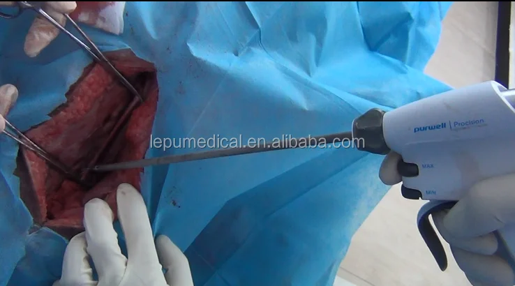 
Ultrasonic Scalpel 
