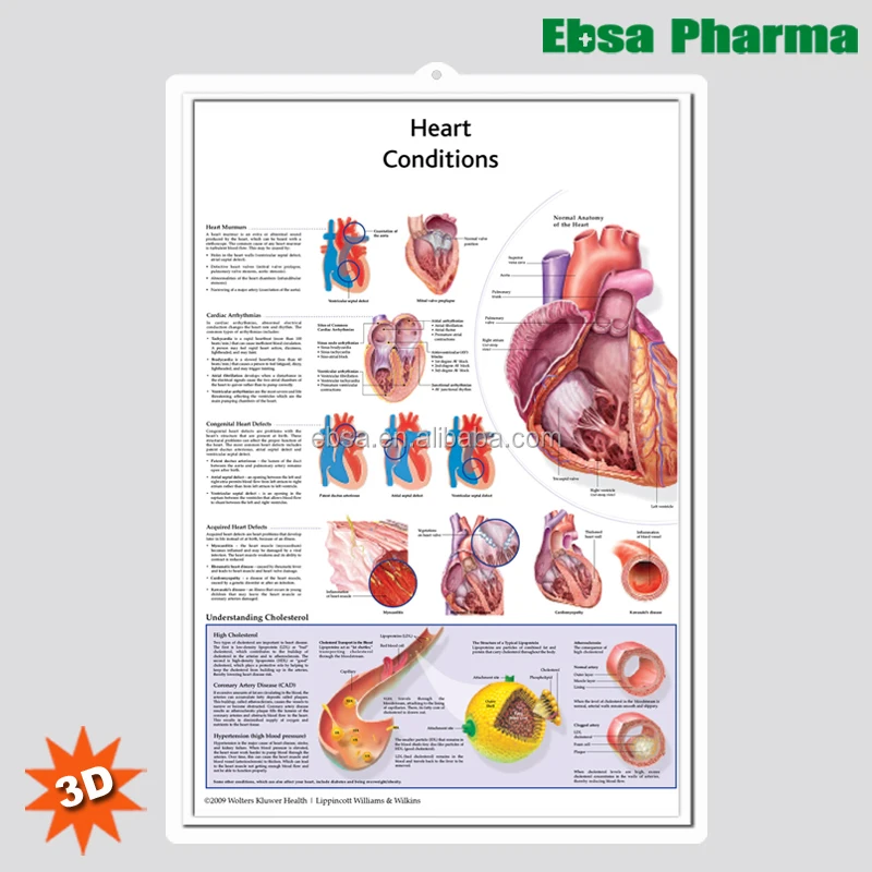 3D Medical Human Anatomy Heart Wall Charts / Poster-Heart Conditions