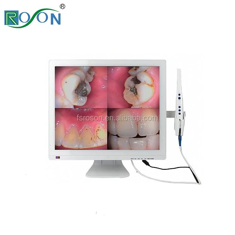 dental intraoral camera with 15 inch monitor price for teeth x ray