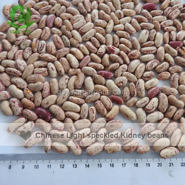 White Beans Type and Kidney Beans Type Light Speckled Kidney Beans