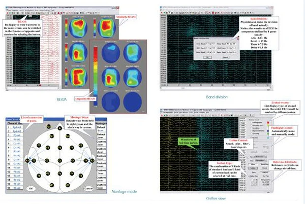 
EEG-1018 Digital Brain Electric Activity Mapping electroencephalogram eeg collects EEG 