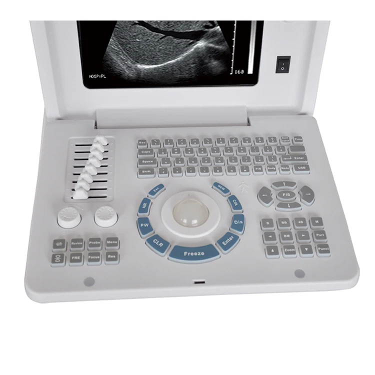 
Gynecological pregnancy examination device portable ultrasound scanner 