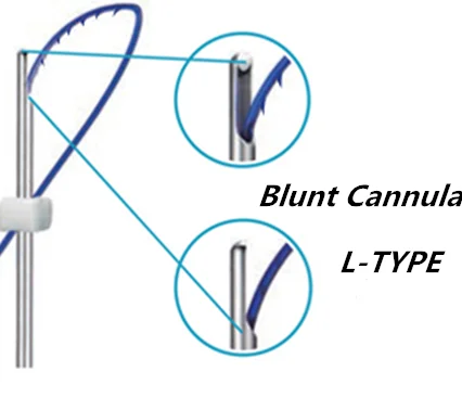 cog 4d 6d L blunt   lifting line of wire lifting surface China pdo thread for facial