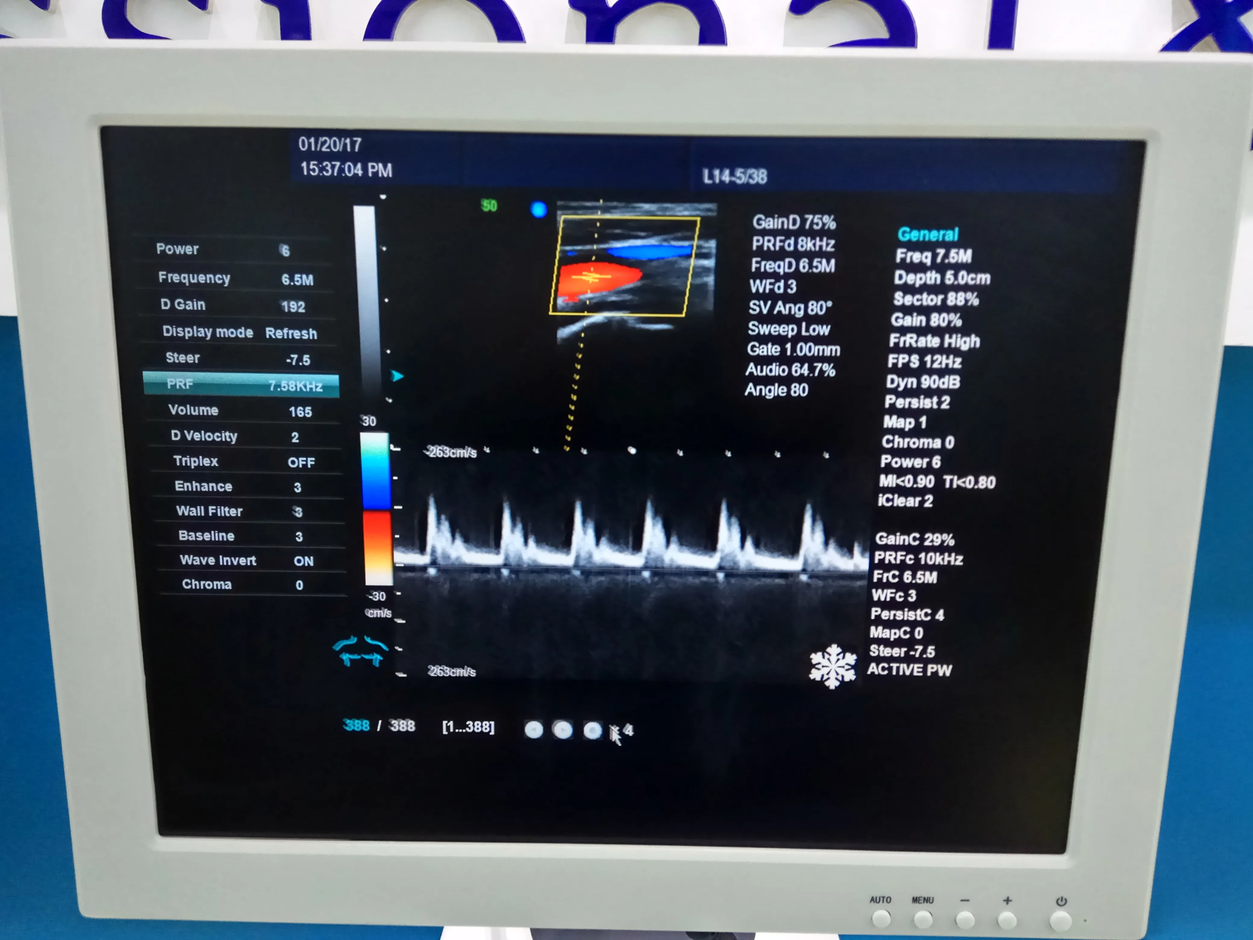 Ультразвуковая диагностическая система Доплера 3D 4D
