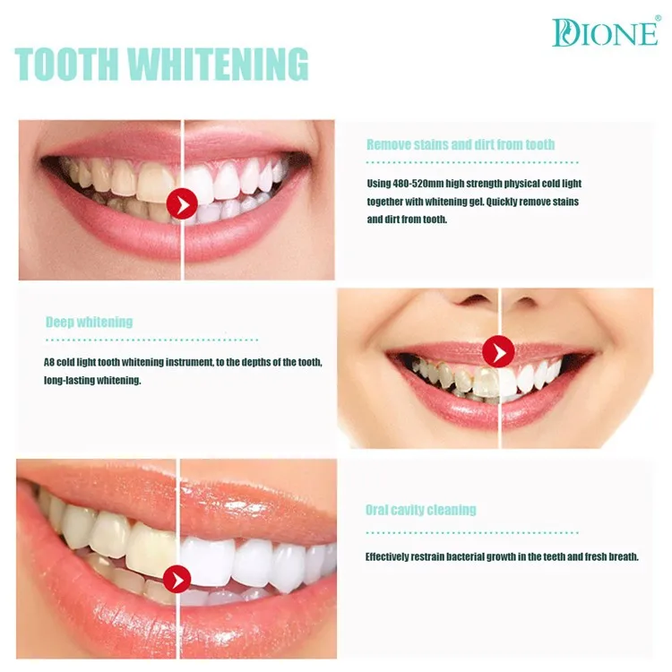 Professional private label Home Take Home Teeth Whitening Kit For Whitening Teeth