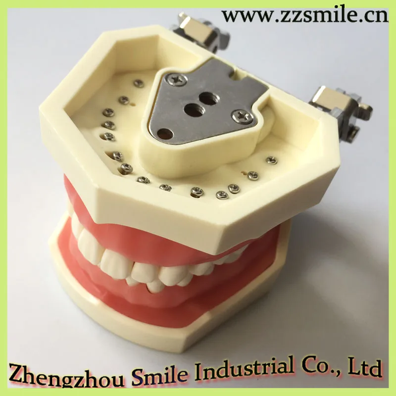 M8011 Standard Dental Tooth Model with 28 Screw in Teeth