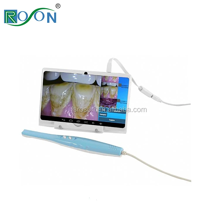 dental intraoral camera with 15 inch monitor price for teeth x ray