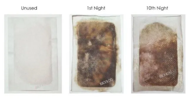 Thailand kinotakara cleansing slim foot patches for beauty purpose