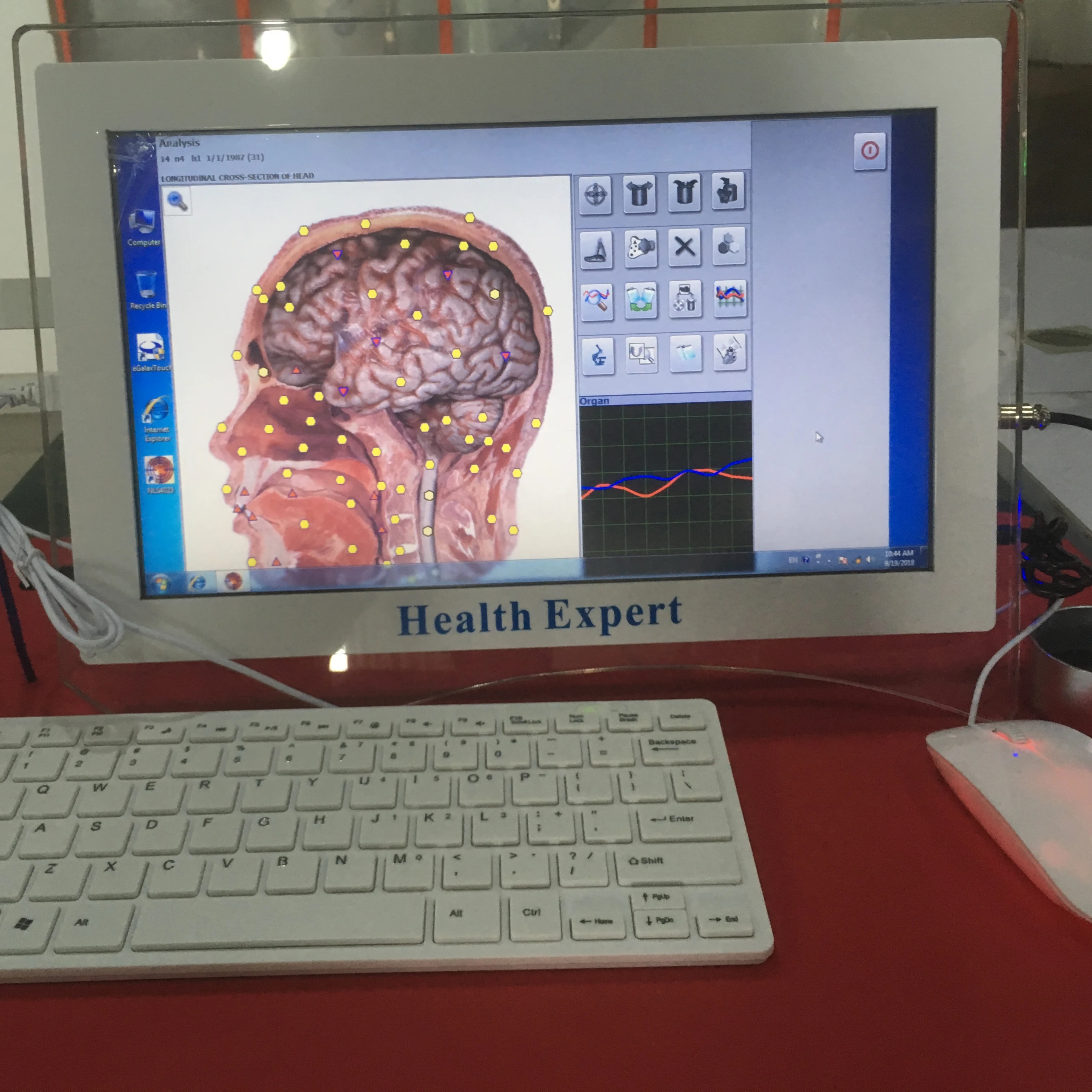 Анализатор контроля всего тела all-in-one 18d nls Wi-Fi анализатор