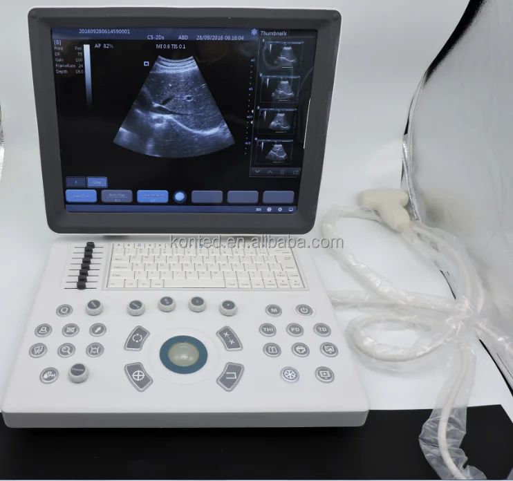 Echocardiograph Machine Portable B Ultrasound Scanner For Sale In Beijing