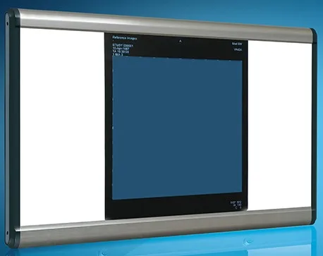 
film viewer LED light box medical agfa x ray blue film 