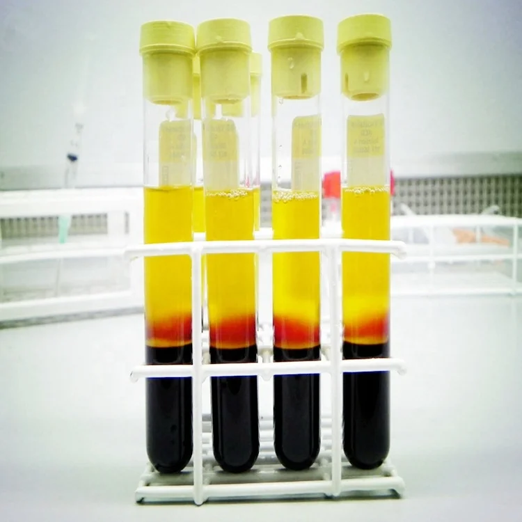 ACD sodium citrate gel Platelet rich plasma PRP tube