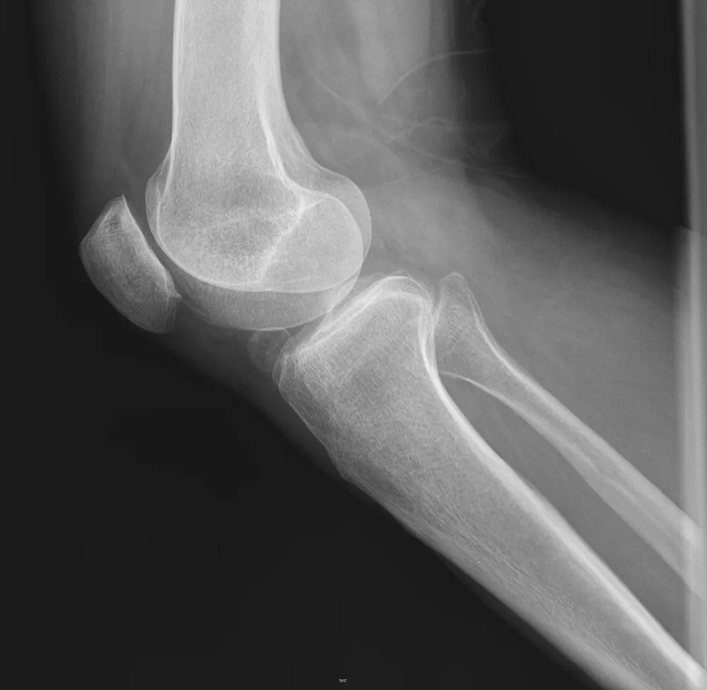 
Hospital radiology department blue color x-ray films Korea market 