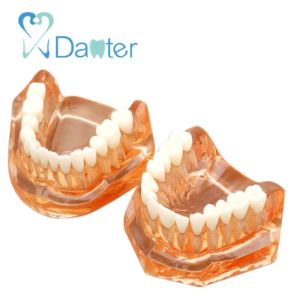 Fantastic Quality Dental Model, Soft Gum with Removable Teeth without Hinge