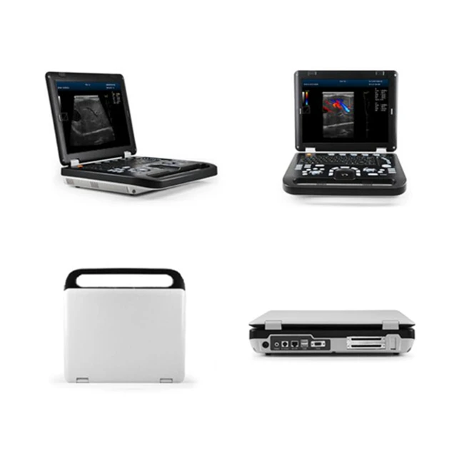 
15' LED Color ultrasound scanner Portable Digital Ultrasonic Color Diagnostic Imaging System 