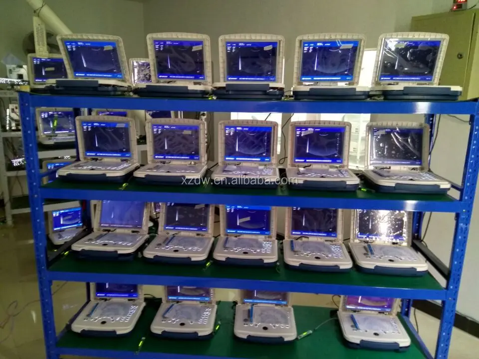 Dawei low price portable ultrasound scan machine for pregnancy DW580