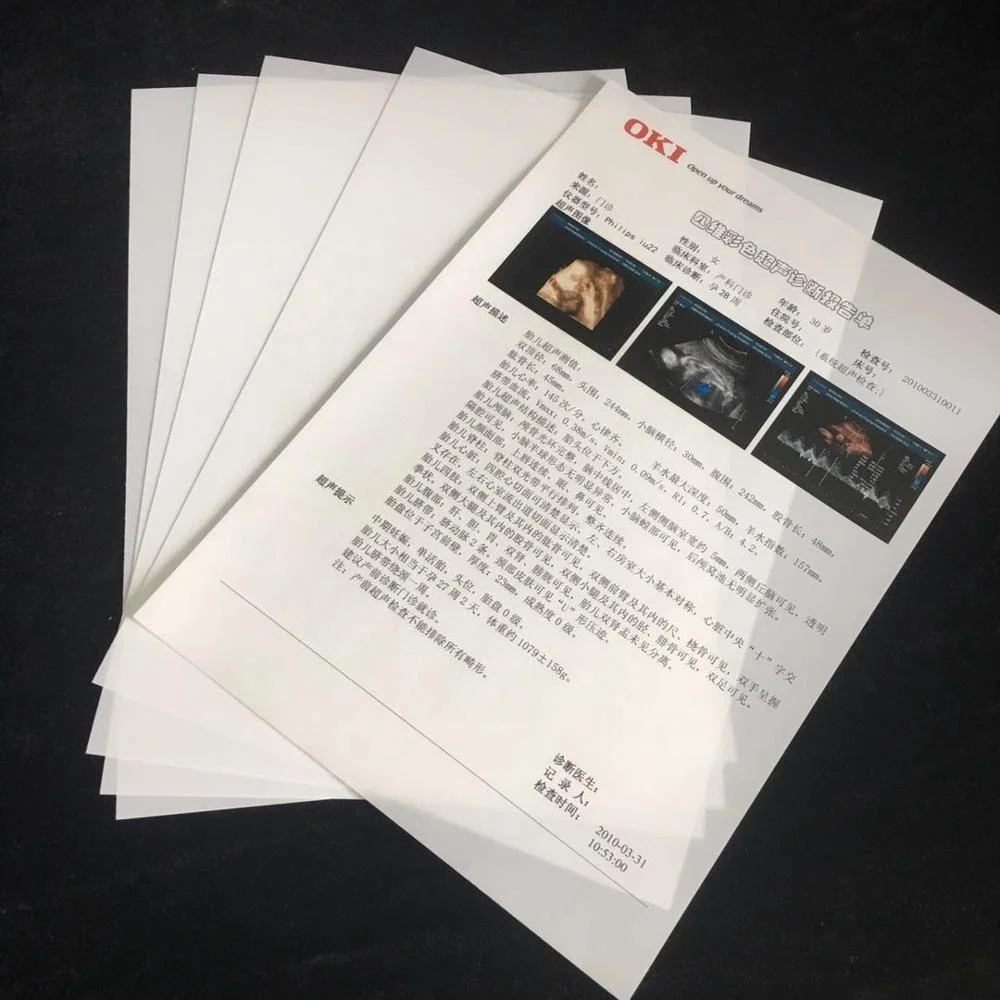 A3/A4 100/125micron Upscale Substitute For Paper In Hospital With White Laser Medical Film PET