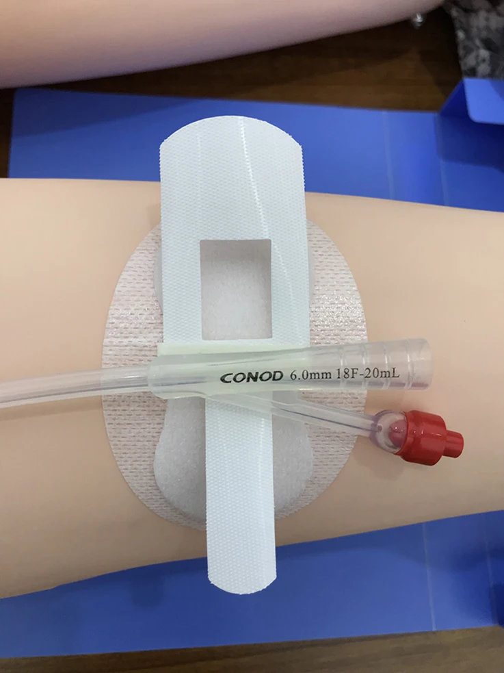 Hot-sale Non-woven Adhesive Catheters Fixation Tube Holder for fixing Catheter Securement