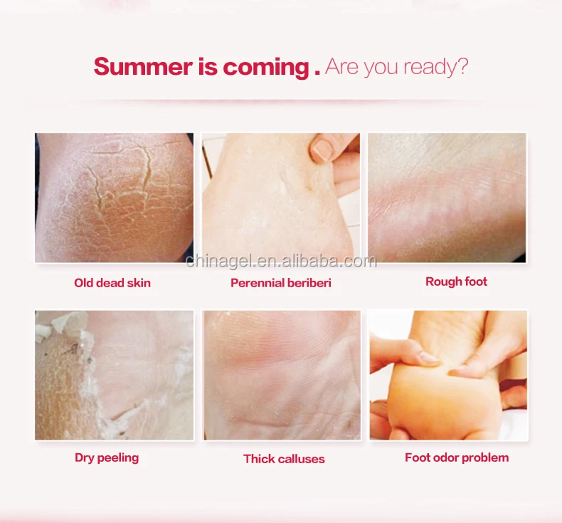 
GMP certificate factory Exfoliating Norsing foot mask peeling foot mask 