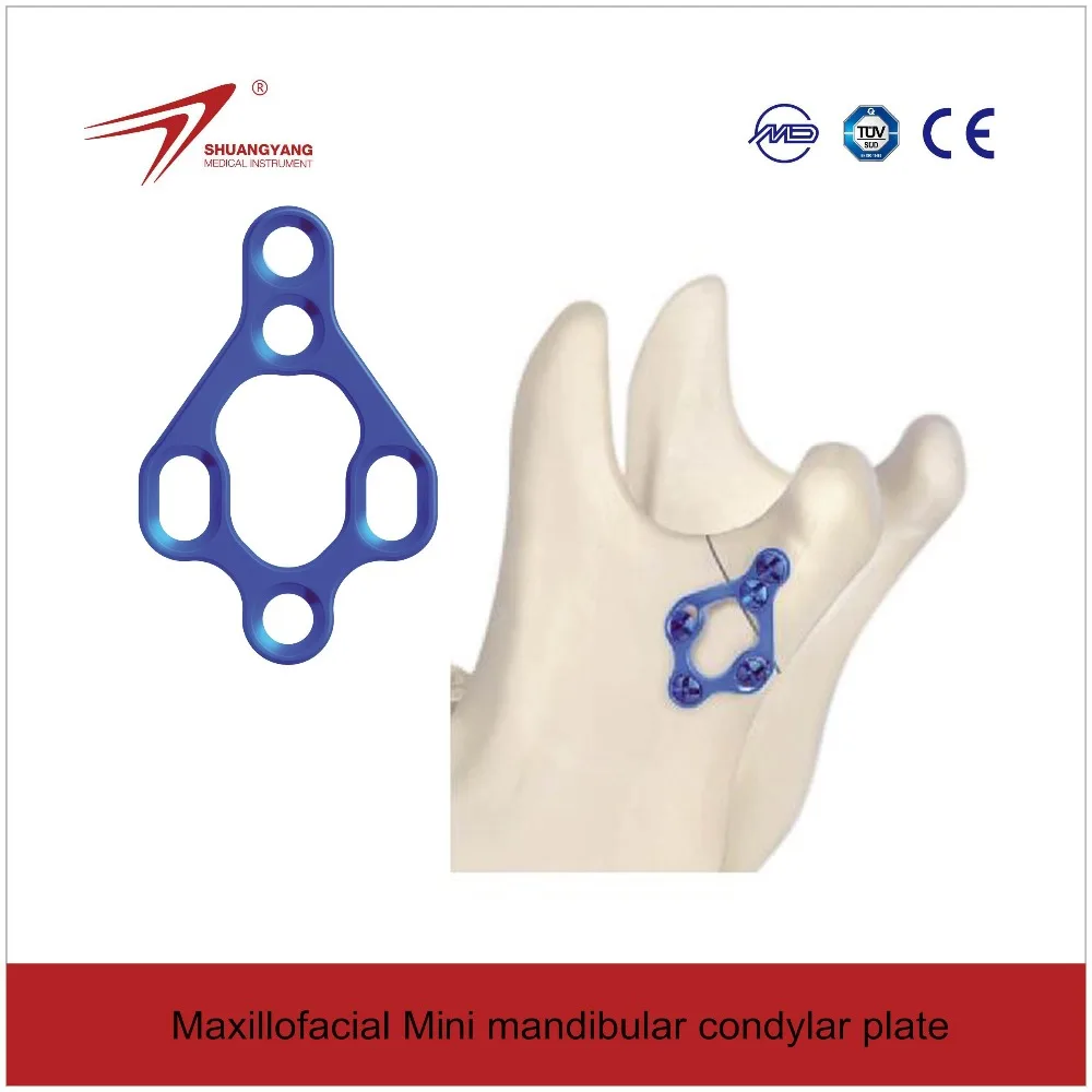 Maxillofacial Mandibular Condylar Mini plate, Titanium bone plate, Orthopedic implant