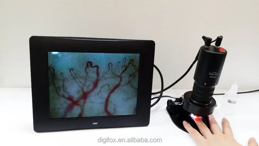 
DMX980-1 Биологический микроскоп микроциркуляции медицинское оборудование капиллярной крови 