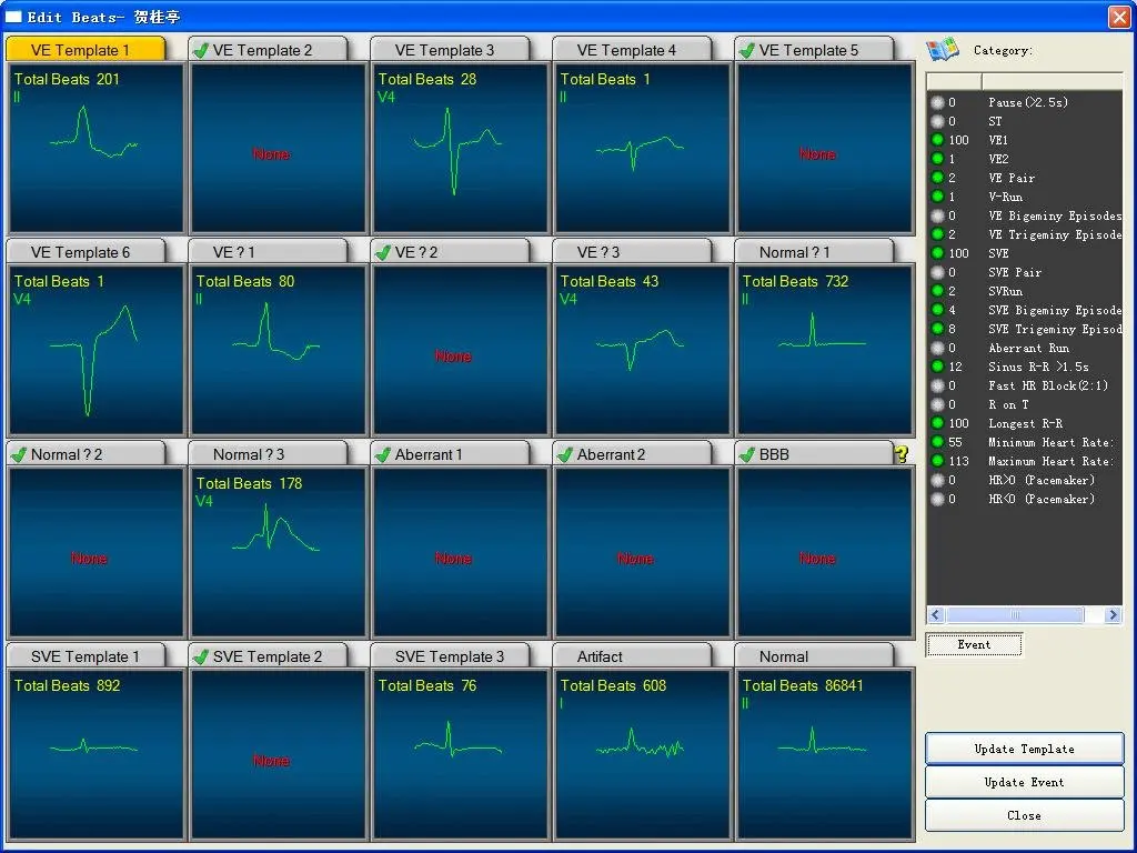 
CE Approved 3 Channels Holter ECG Holter Recorder Machine 
