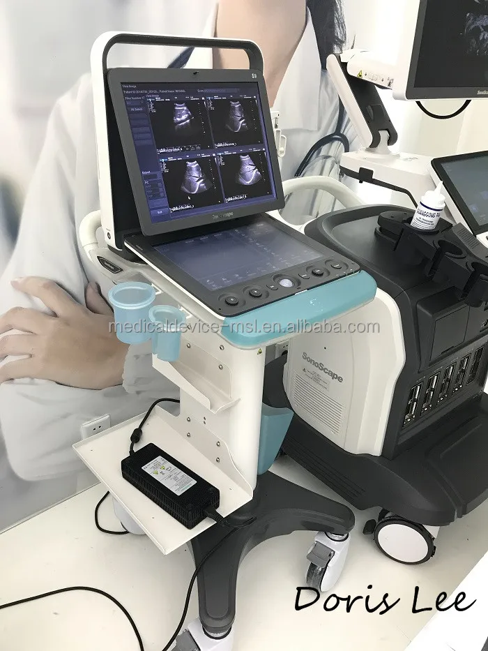 Новейшая модель портативная цветная допплеровская ультразвуковая машина SonoScape S9 цена