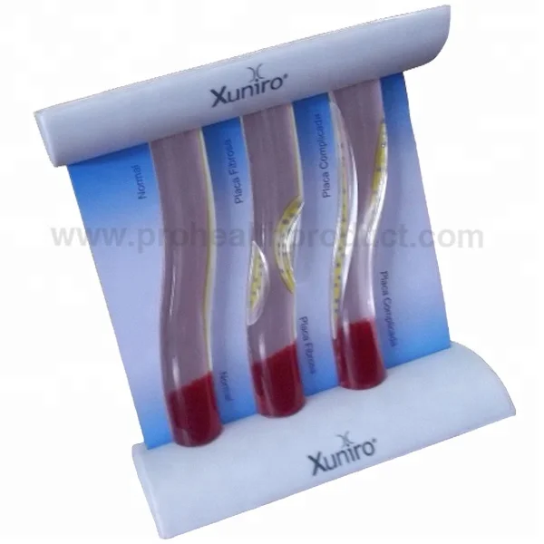 Dynamic vascular Blood Vessel Educational Teaching Model, LDL Low-density Lipoprotein Vascular Disease Model