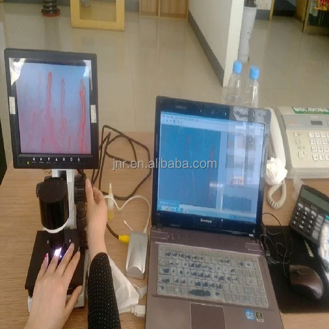 factory microcirculation microscope euqipments