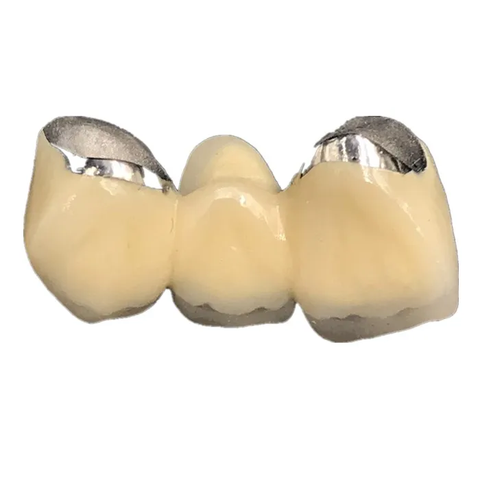 
Good metal and porcelain false teeth 